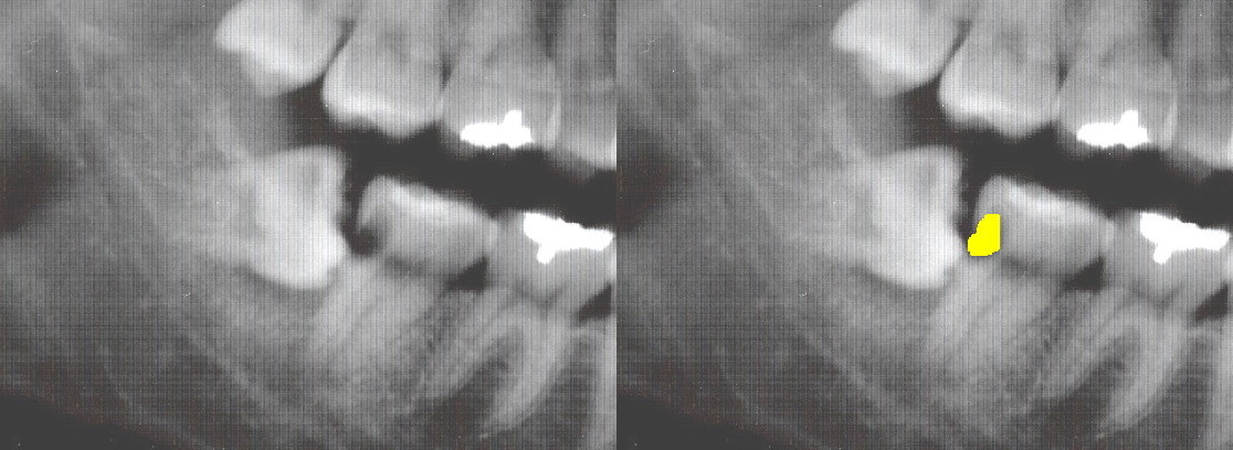 2molar-decay